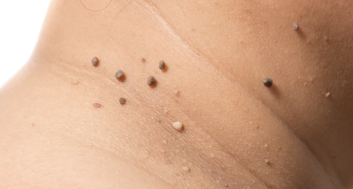 Kaitan Antara Keseimbangan Internal dan Estetika Luar: Kunci Menuju Kulit Bersih yang Sempurna